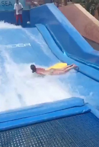 英女子四年前水上乐园冲浪险瘫痪 至今仍未获赔(图2)