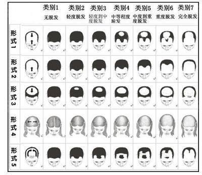防脱洗发水哪种效果好？体验不脱发的感觉！