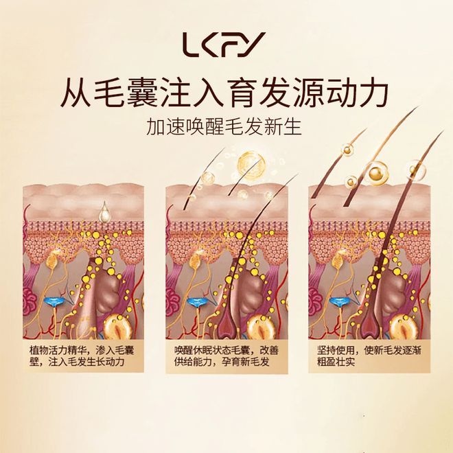 防脱洗发水哪种效果好？体验不脱发的感觉！(图3)