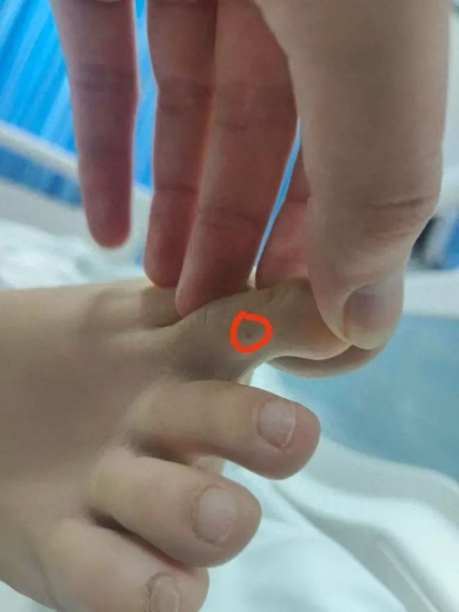 女子被不明物咬伤身亡海南公示29家各级医院抗蛇毒血清储备情况