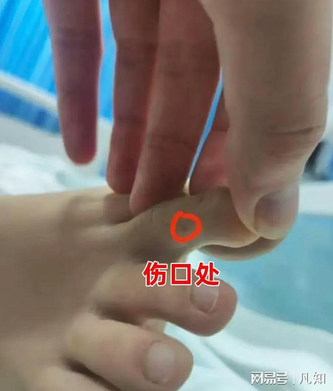 27岁女孩被蛇咬身亡后续：生活照曝光家属透露更多细节 官方通(图6)